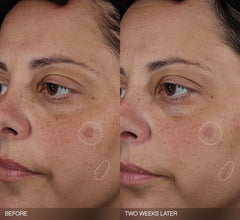 Faded Complete Dark Spot Bundle